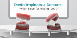 Dental Implants vs dentures